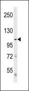 Unc-51 Like Autophagy Activating Kinase 1 antibody, GTX80551, GeneTex, Western Blot image 