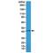 Actin Alpha 2, Smooth Muscle antibody, M01072-4, Boster Biological Technology, Western Blot image 