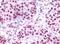 Lysine Demethylase 1A antibody, NB100-1762, Novus Biologicals, Immunohistochemistry paraffin image 
