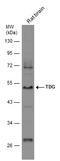 Thymine DNA Glycosylase antibody, GTX127975, GeneTex, Western Blot image 