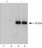Insulin Receptor antibody, 44-802G, Invitrogen Antibodies, Western Blot image 