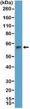 DNA Nucleotidylexotransferase antibody, NBP2-77436, Novus Biologicals, Western Blot image 