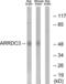 Arrestin Domain Containing 3 antibody, LS-B7200, Lifespan Biosciences, Western Blot image 