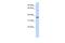 Chromosome 16 Open Reading Frame 46 antibody, A17488, Boster Biological Technology, Western Blot image 