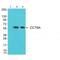 Chaperonin Containing TCP1 Subunit 6A antibody, A09373, Boster Biological Technology, Western Blot image 