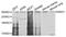 Nuclear Receptor Binding SET Domain Protein 1 antibody, A02327-1, Boster Biological Technology, Western Blot image 