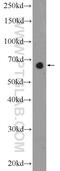 GATA Zinc Finger Domain Containing 2B antibody, 25679-1-AP, Proteintech Group, Western Blot image 