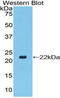Toll Like Receptor 7 antibody, LS-C296711, Lifespan Biosciences, Western Blot image 