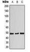 Cyclin E1 antibody, LS-C353930, Lifespan Biosciences, Western Blot image 