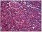 Spleen Associated Tyrosine Kinase antibody, AP31201PU-N, Origene, Immunohistochemistry frozen image 