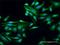 WT1 Interacting Protein antibody, H00126374-D01P, Novus Biologicals, Immunocytochemistry image 
