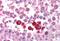 Checkpoint Kinase 2 antibody, MBS241264, MyBioSource, Immunohistochemistry paraffin image 