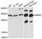 Nuclear Receptor Interacting Protein 2 antibody, LS-C748913, Lifespan Biosciences, Western Blot image 