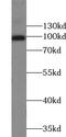 Teashirt Zinc Finger Homeobox 3 antibody, FNab09046, FineTest, Western Blot image 