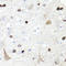 Insulin Like Growth Factor Binding Protein 5 antibody, STJ114325, St John