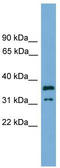 Potassium Channel Tetramerization Domain Containing 21 antibody, TA334961, Origene, Western Blot image 