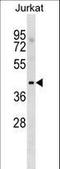 Mannosyl (Alpha-1,3-)-Glycoprotein Beta-1,2-N-Acetylglucosaminyltransferase antibody, LS-C164172, Lifespan Biosciences, Western Blot image 