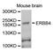 Erb-B2 Receptor Tyrosine Kinase 4 antibody, STJ27886, St John