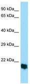 M-Phase Specific PLK1 Interacting Protein antibody, TA333539, Origene, Western Blot image 