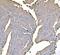 Pyruvate Kinase M1/2 antibody, M01173-1, Boster Biological Technology, Immunohistochemistry paraffin image 