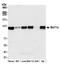 BAF Chromatin Remodeling Complex Subunit BCL11A antibody, NBP2-78710, Novus Biologicals, Western Blot image 