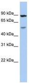 Aldehyde Dehydrogenase 6 Family Member A1 antibody, TA339014, Origene, Western Blot image 