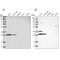 Translational Activator Of Cytochrome C Oxidase I antibody, NBP1-88161, Novus Biologicals, Western Blot image 