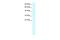 Caudal Type Homeobox 4 antibody, A10130, Boster Biological Technology, Western Blot image 