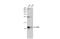 ENY2 Transcription And Export Complex 2 Subunit antibody, GTX128034, GeneTex, Western Blot image 