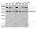 Serpin Family B Member 3 antibody, A5418, ABclonal Technology, Western Blot image 