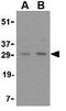 TNF Superfamily Member 11 antibody, GTX31300, GeneTex, Western Blot image 