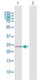 RAN Binding Protein 1 antibody, H00005902-D01P, Novus Biologicals, Western Blot image 