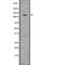 Unc-51 Like Autophagy Activating Kinase 1 antibody, abx219250, Abbexa, Western Blot image 