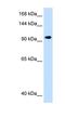 SEC63 Homolog, Protein Translocation Regulator antibody, NBP1-59694, Novus Biologicals, Western Blot image 