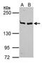 MutS Homolog 6 antibody, GTX111661, GeneTex, Western Blot image 