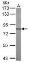 Tubulin Tyrosine Ligase Like 12 antibody, PA5-31740, Invitrogen Antibodies, Western Blot image 