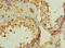 Mannose Receptor C Type 2 antibody, LS-C676072, Lifespan Biosciences, Immunohistochemistry paraffin image 