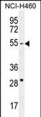 CD2 Cytoplasmic Tail Binding Protein 2 antibody, PA5-71466, Invitrogen Antibodies, Western Blot image 