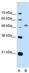 Paired Box 8 antibody, TA346520, Origene, Western Blot image 