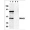 Serine/Threonine Kinase 17b antibody, MBS151387, MyBioSource, Western Blot image 