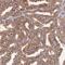 Cyclin Dependent Kinase 18 antibody, NBP1-92249, Novus Biologicals, Immunohistochemistry paraffin image 