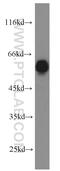 Pre-MRNA Processing Factor 19 antibody, 15414-1-AP, Proteintech Group, Western Blot image 