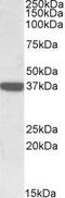 Calponin 3 antibody, GTX88571, GeneTex, Western Blot image 