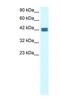 Olfactory Receptor Family 13 Subfamily C Member 9 antibody, NBP1-79985, Novus Biologicals, Western Blot image 