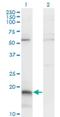 GD antibody, H00005047-M01, Novus Biologicals, Western Blot image 