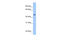 Ankyrin Repeat And SOCS Box Containing 6 antibody, ARP53352_P050, Aviva Systems Biology, Western Blot image 