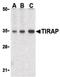 TIR Domain Containing Adaptor Protein antibody, PA5-20028, Invitrogen Antibodies, Western Blot image 