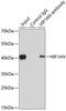 Hypoxia Inducible Factor 1 Subunit Alpha Inhibitor antibody, 19-681, ProSci, Immunoprecipitation image 