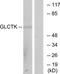 Glycerate Kinase antibody, TA316105, Origene, Western Blot image 