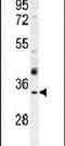 Olfactory Receptor Family 51 Subfamily I Member 1 antibody, PA5-24135, Invitrogen Antibodies, Western Blot image 